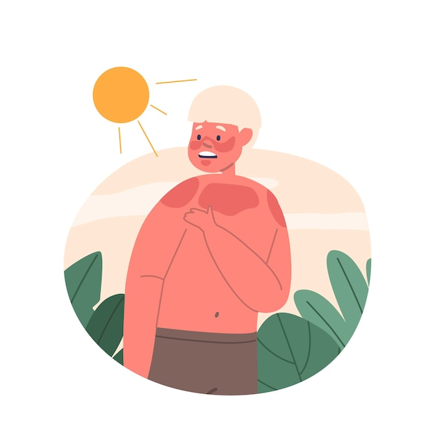 Uncomfortable And Red Little Boy Character With Painful Sunburn Seeking Relief And In Need Of Soothing Remedies