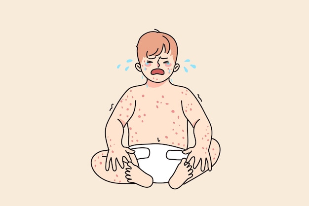 Unhappy baby infant crying suffer from eczema or dermatology disease. Upset sad little kid newborn child stressed with measles or chickenpox. Children healthcare concept. Vector illustration.