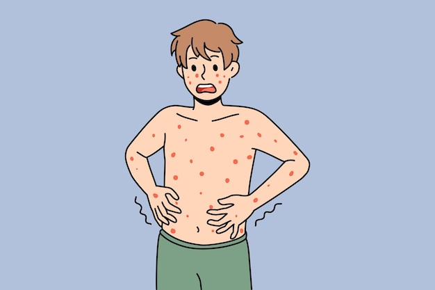 Unhealthy boy with red spots on body suffer from measles or rubella. Anxious unwell man struggle with rash fever, have severe symptoms. Healthcare concept. Flat vector illustration.