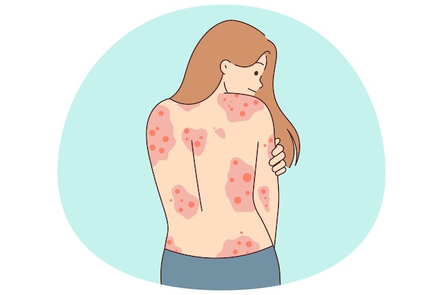 Vector unhealthy woman show red rash on back