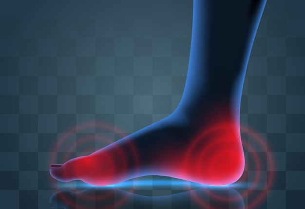 Vector vector human foot blue contour and red spots of pain ready element for medicine and orthopedics