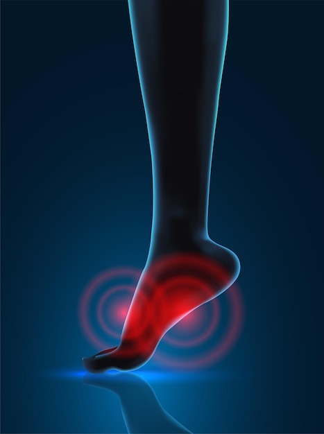 vector human foot blue contour and red spots of pain ready element for medicine and orthopedics