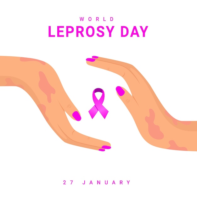 Vector illustration hand affected leprosy, world leprosy day in January