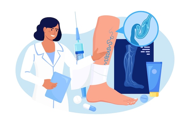 Vein Thrombosis and Varicose Treatment. Surgeon treat vascular diseases, apply tight bandage. Doctor near Big Foot with Diseased Veins. Doppler ultrasonography of the lower extremity arteries