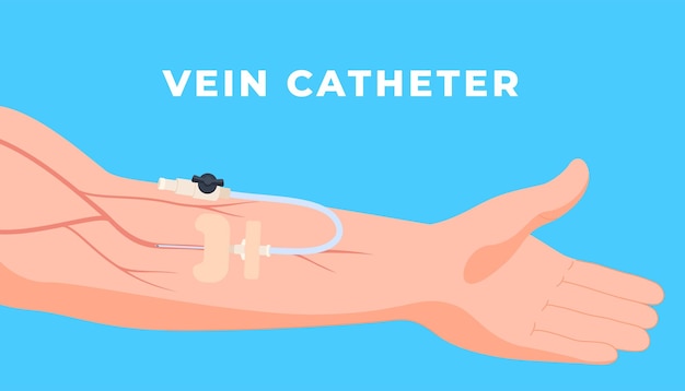 Venous Medical sterile catheters for patient treatment Medical tools for accessing blood vessels and internal organs Vector illustration