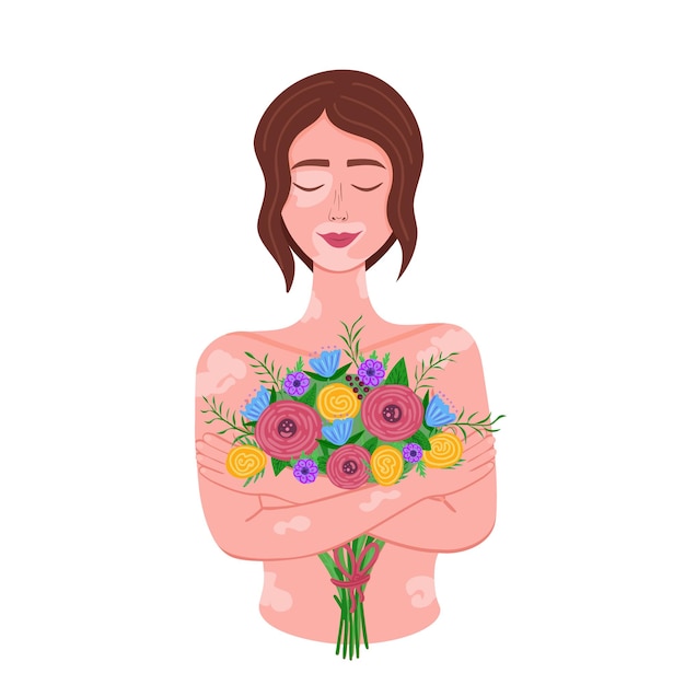 Vitiligo girl with flowers World Vitiligo Day Love yourself accept your body Illustration for printing backgrounds cover packaging greeting cards posters Isolated on white background