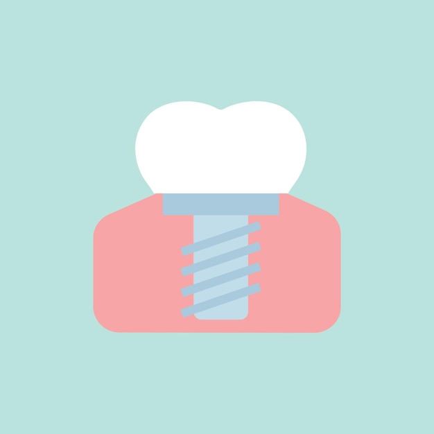 White tooth with implant Vector illustration