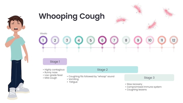 Whooping Cough Pertussis Symptom Timeline vector illustration infographic