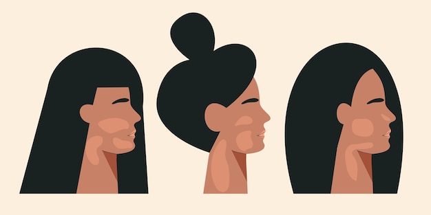 Women silhouette with vitiligo chronic skin pigmentation disorder. World vitiligo day concept. Portrait of girl with skin disease. Different Beauty. Flat vector illustration isolated white