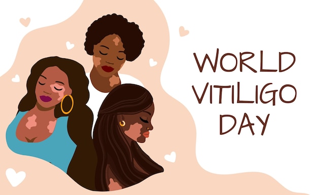 World Vitiligo Day Vector Banner